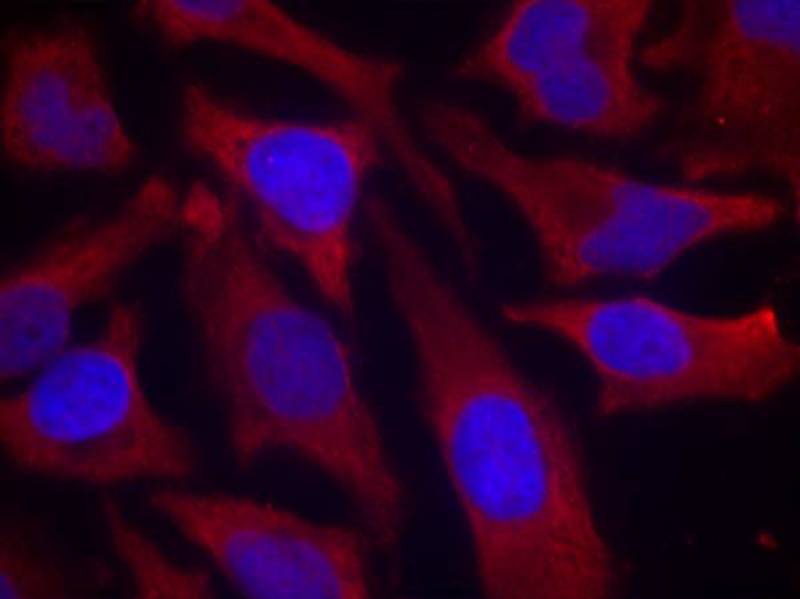 Anti-Phospho-synapsin I (Ser9) Rabbit Polyclonal Antibody