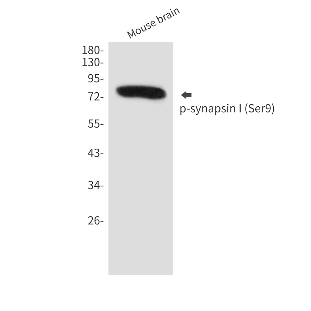 Anti-Phospho-synapsin I (Ser9) Rabbit Polyclonal Antibody