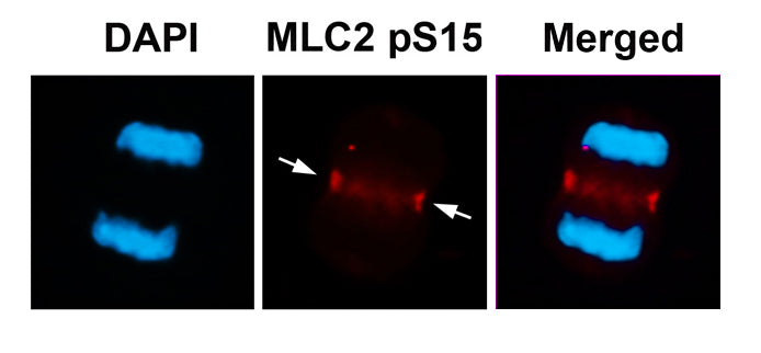 Anti-Phospho-Myosin Light Chain 2 (Ser15) Rabbit Polyclonal Antibody