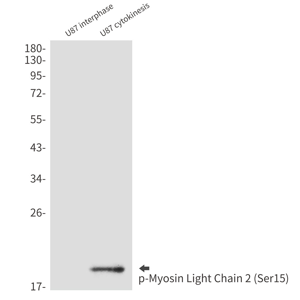 Anti-Phospho-Myosin Light Chain 2 (Ser15) Rabbit Polyclonal Antibody