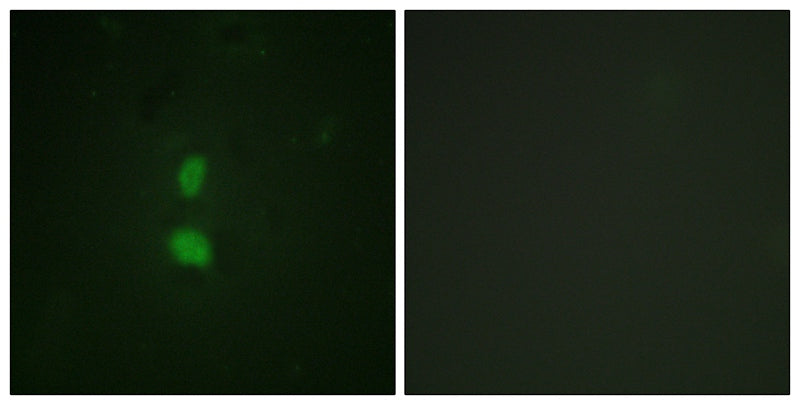 Anti-Phospho-SNAI1 (Ser246) Rabbit Polyclonal Antibody