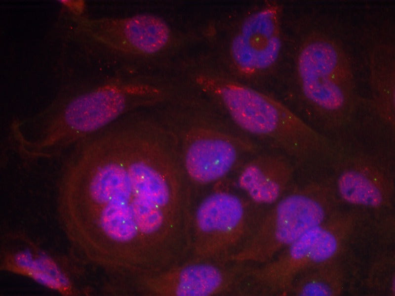 Anti-Phospho-NF-KB p65 (Ser276) Rabbit Polyclonal Antibody