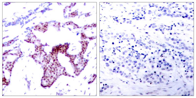 Anti-Phospho-NF-KB p65 (Ser276) Rabbit Polyclonal Antibody