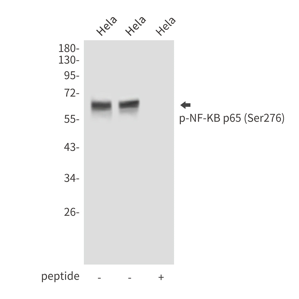 Anti-Phospho-NF-KB p65 (Ser276) Rabbit Polyclonal Antibody