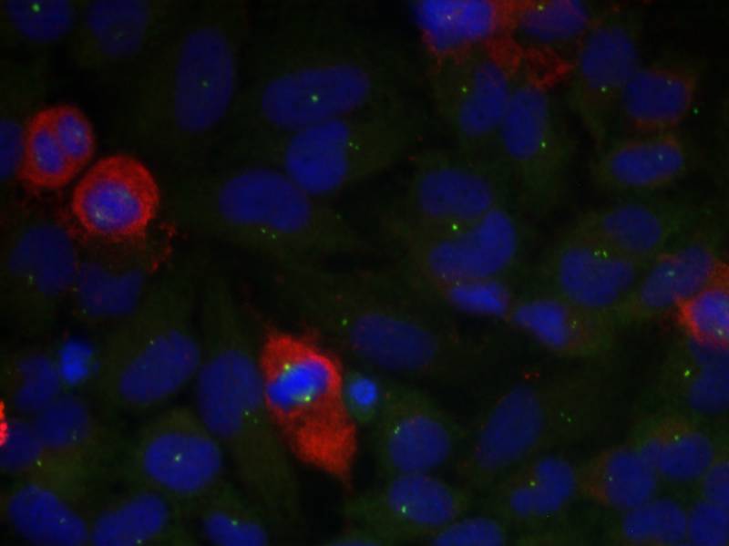 Anti-Phospho-NF-KB p65 (Thr435) Rabbit Polyclonal Antibody