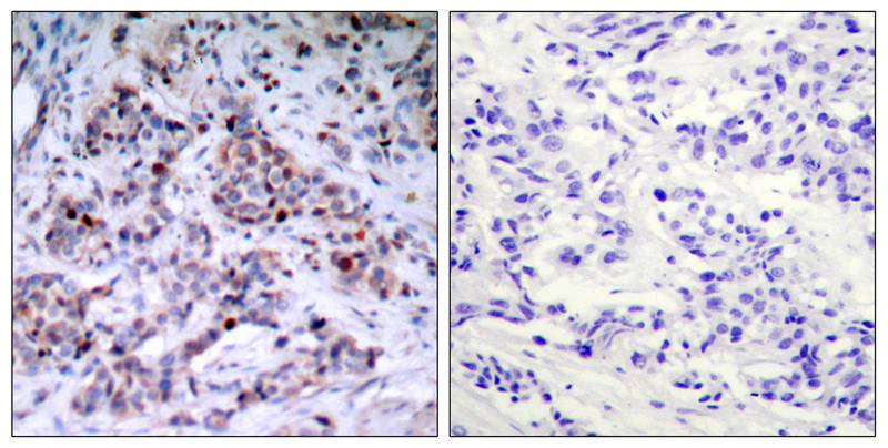 Anti-Phospho-NF-KB p65 (Thr435) Rabbit Polyclonal Antibody