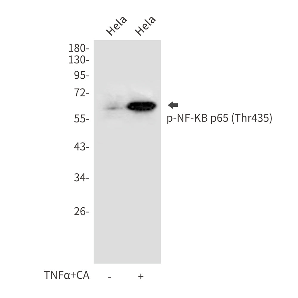 Anti-Phospho-NF-KB p65 (Thr435) Rabbit Polyclonal Antibody