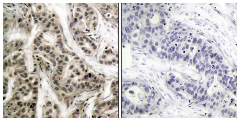 Anti-Phospho-NF-KB p105/p50 (Ser337) Rabbit Polyclonal Antibody