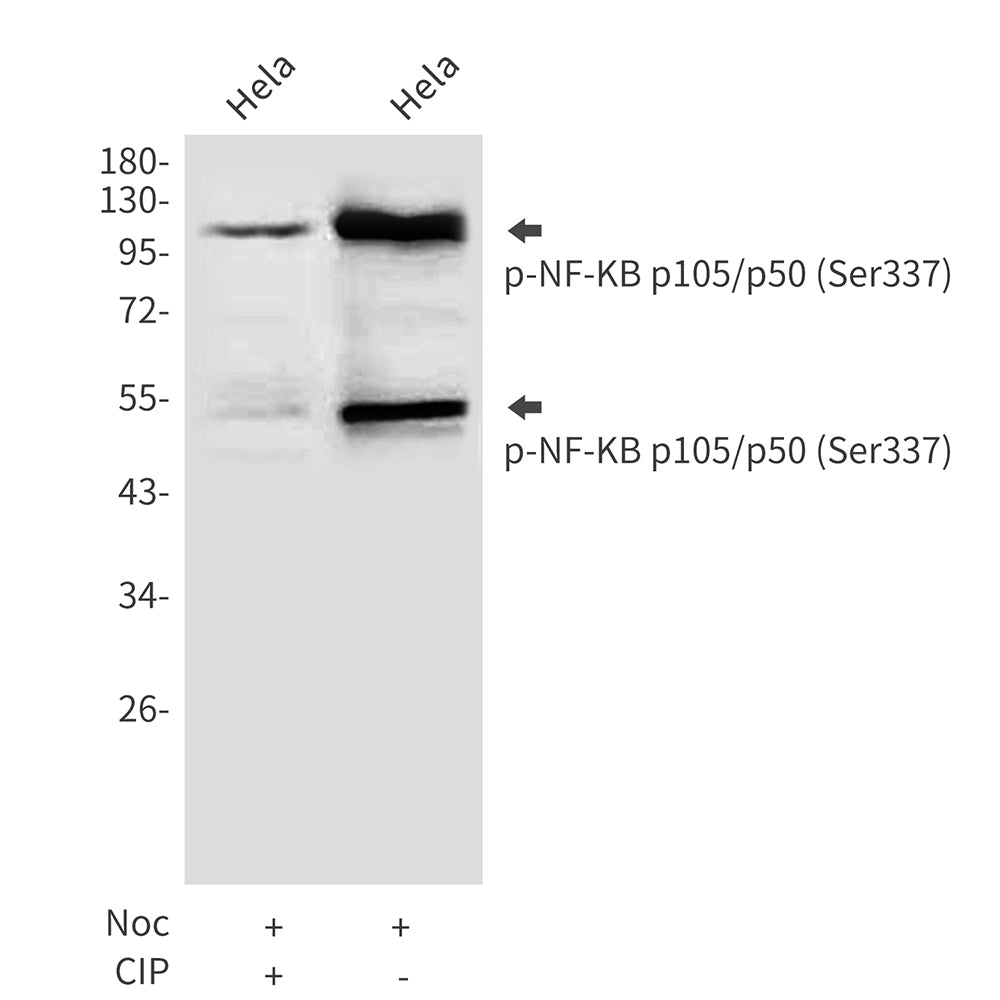 Anti-Phospho-NF-KB p105/p50 (Ser337) Rabbit Polyclonal Antibody