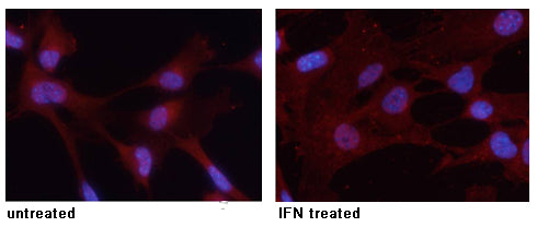 Anti-Phospho-STAT3 (Tyr705) Rabbit Polyclonal Antibody