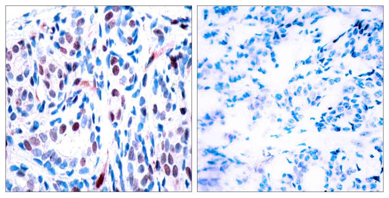 Anti-Phospho-STAT3 (Tyr705) Rabbit Polyclonal Antibody