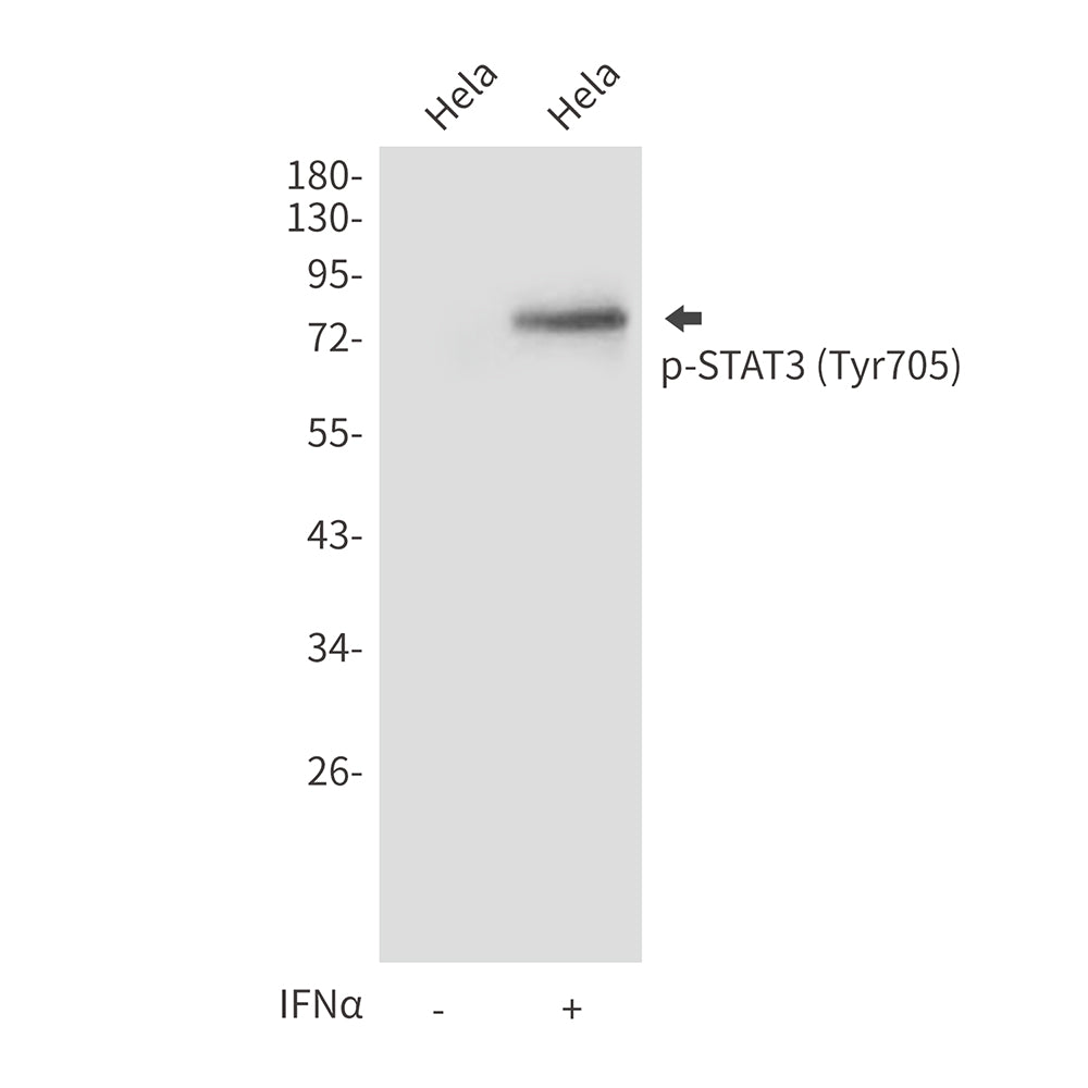 Anti-Phospho-STAT3 (Tyr705) Rabbit Polyclonal Antibody