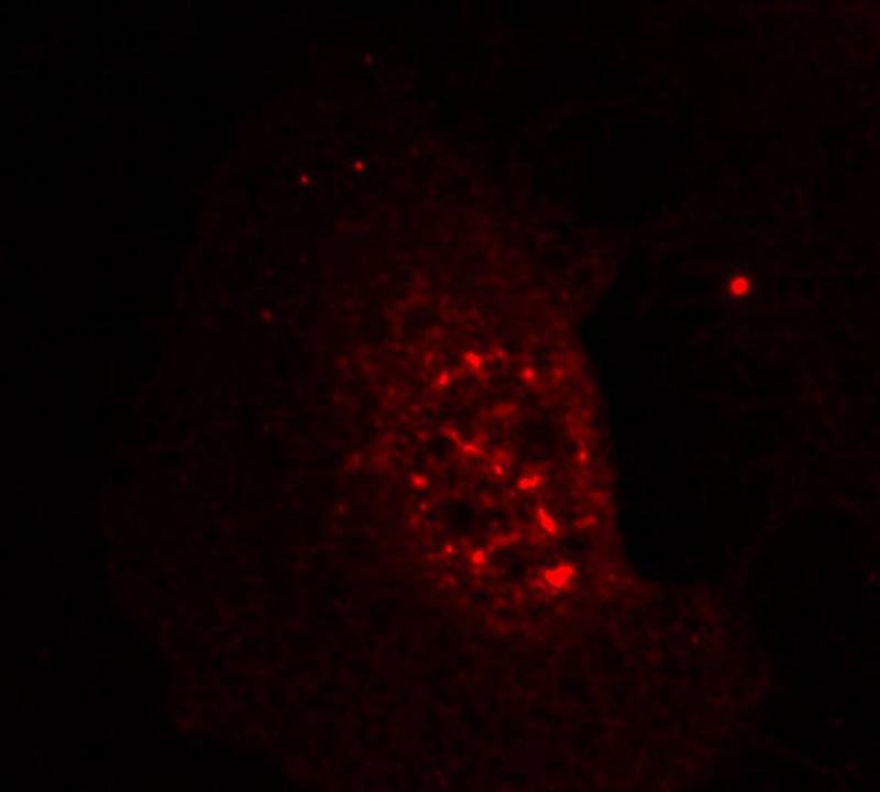 Anti-Phospho-AKT (Thr308) Rabbit Polyclonal Antibody