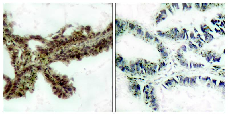 Anti-Phospho-AKT (Thr308) Rabbit Polyclonal Antibody