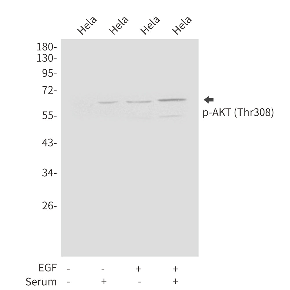Anti-Phospho-AKT (Thr308) Rabbit Polyclonal Antibody