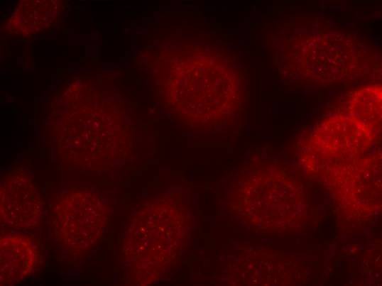 Anti-Phospho-PTEN (Ser370) Rabbit Polyclonal Antibody