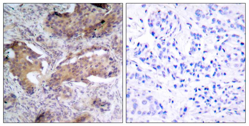 Anti-Phospho-PTEN (Ser370) Rabbit Polyclonal Antibody
