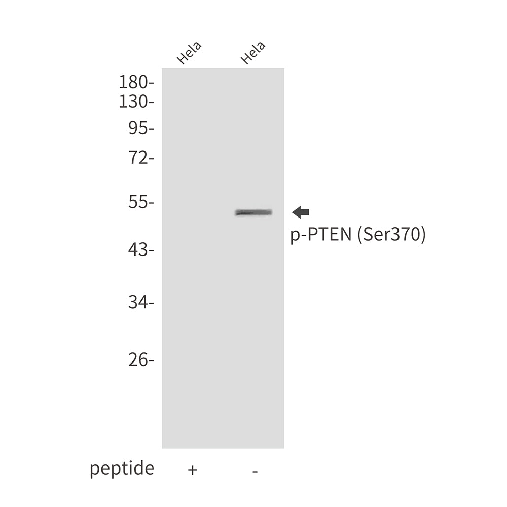 Anti-Phospho-PTEN (Ser370) Rabbit Polyclonal Antibody
