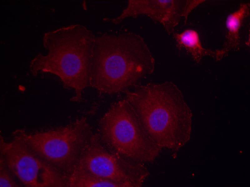 Anti-Phospho-ErbB 2 (Tyr877) Rabbit Polyclonal Antibody