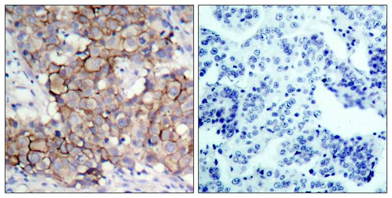 Anti-Phospho-ErbB 2 (Tyr877) Rabbit Polyclonal Antibody