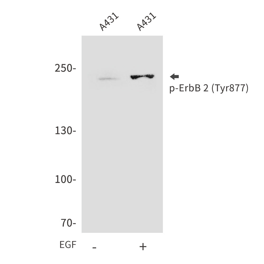 Anti-Phospho-ErbB 2 (Tyr877) Rabbit Polyclonal Antibody