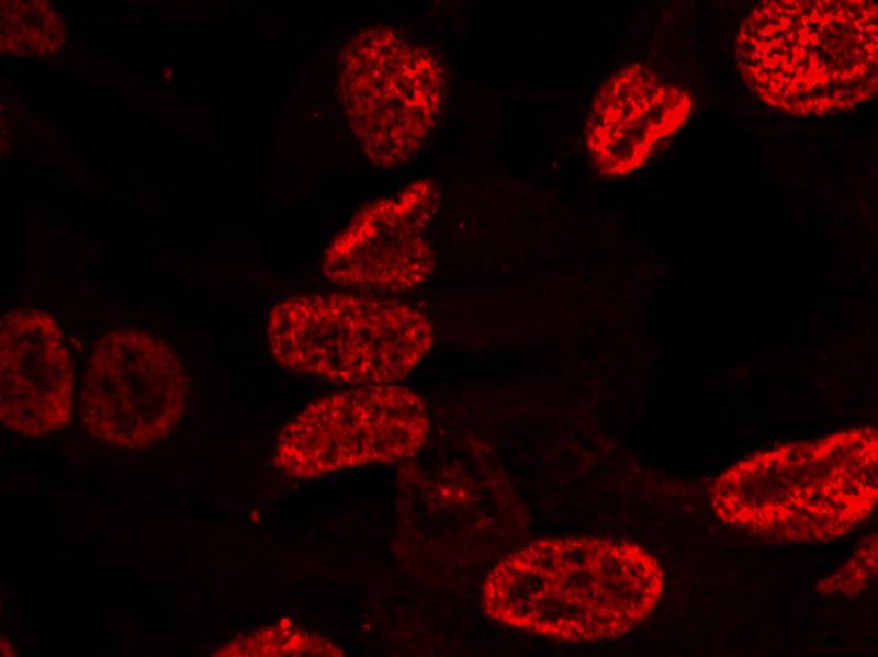 Anti-Phospho-p53 (Ser15) Rabbit Polyclonal Antibody