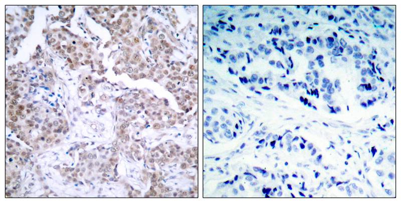 Anti-Phospho-p53 (Ser15) Rabbit Polyclonal Antibody