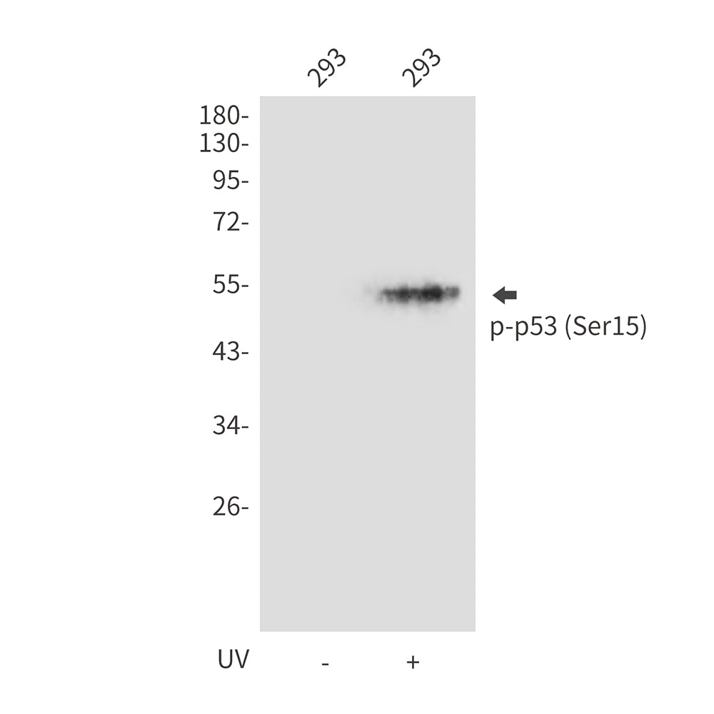 Anti-Phospho-p53 (Ser15) Rabbit Polyclonal Antibody