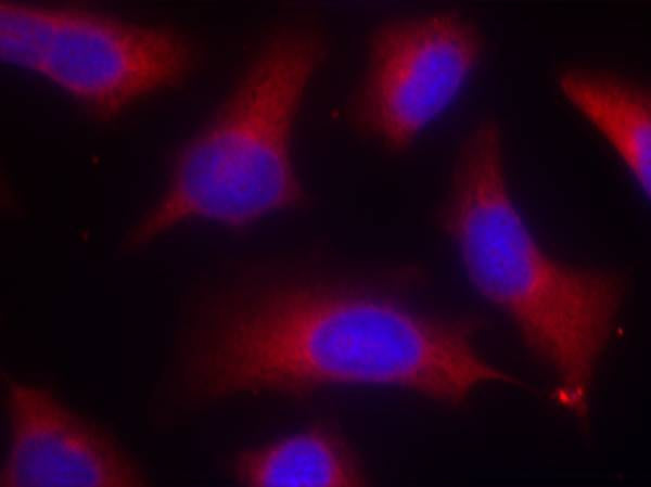 Anti-Phospho-Tau (Ser262) Rabbit Polyclonal Antibody