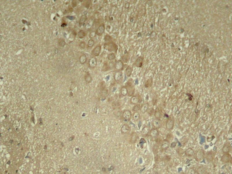 Anti-Phospho-Tau (Ser262) Rabbit Polyclonal Antibody