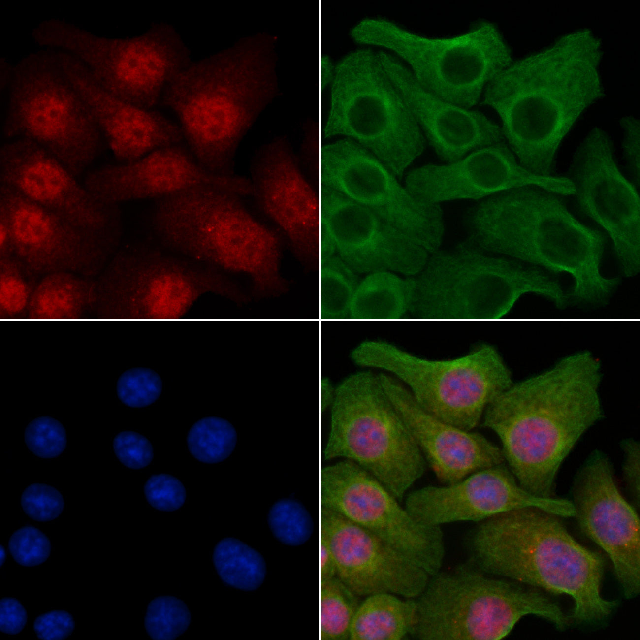 Anti-Phospho-FOXO1 (Ser256) Rabbit Polyclonal Antibody