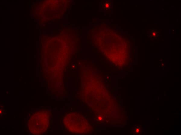 Anti-Phospho-LIM Kinase 1 (Thr508) Rabbit Polyclonal Antibody