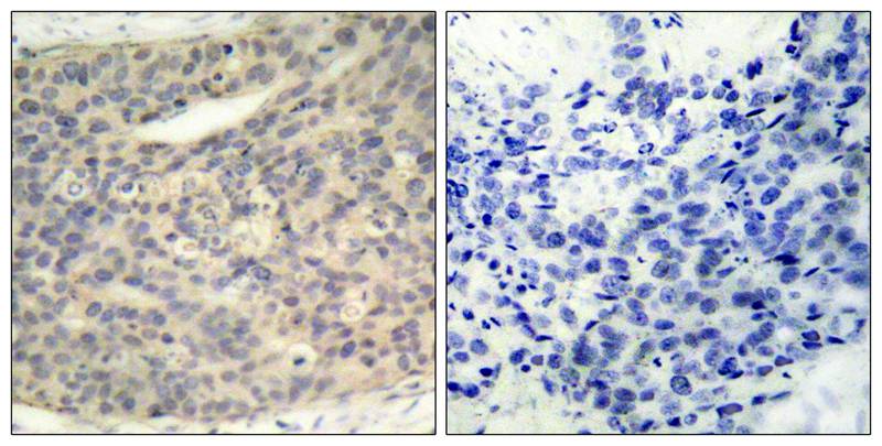 Anti-Phospho-LIM Kinase 1 (Thr508) Rabbit Polyclonal Antibody