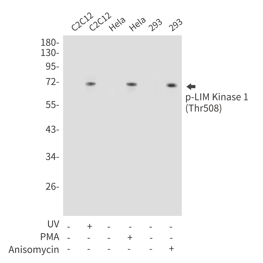 Anti-Phospho-LIM Kinase 1 (Thr508) Rabbit Polyclonal Antibody