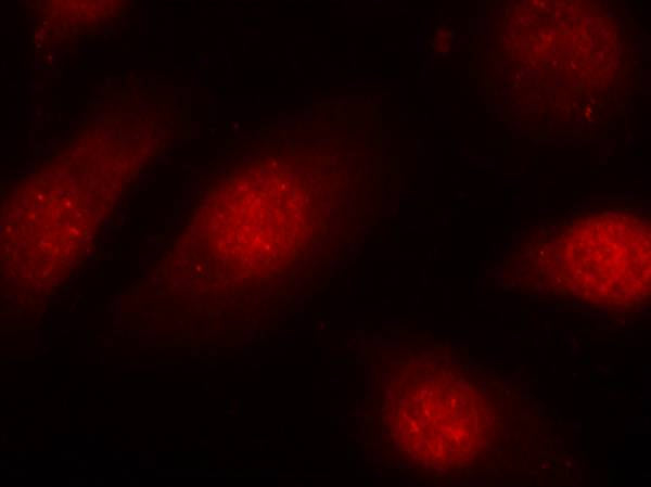 Anti-Phospho-Rb (Ser780) Rabbit Polyclonal Antibody