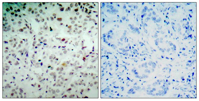 Anti-Phospho-Rb (Ser780) Rabbit Polyclonal Antibody