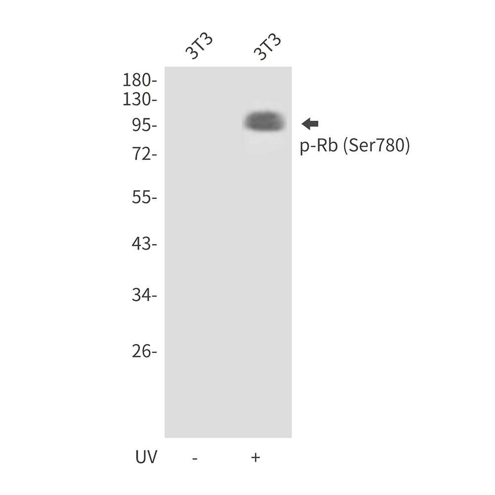 Anti-Phospho-Rb (Ser780) Rabbit Polyclonal Antibody