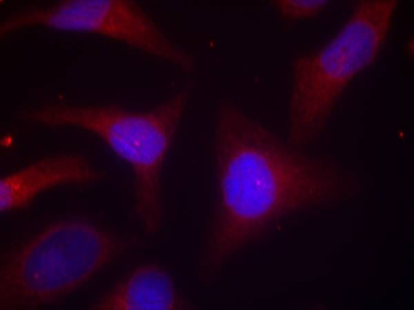 Anti-Phospho-IKB alpha (Ser32/Ser36) Rabbit Polyclonal Antibody