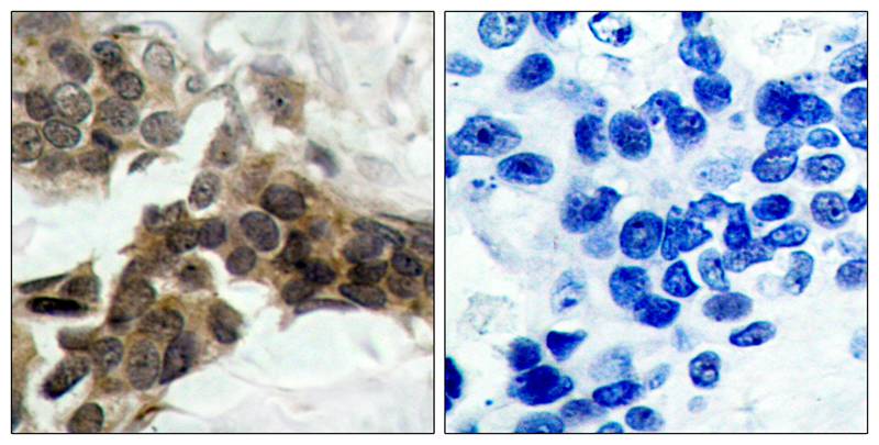 Anti-Phospho-IKB alpha (Ser32/Ser36) Rabbit Polyclonal Antibody