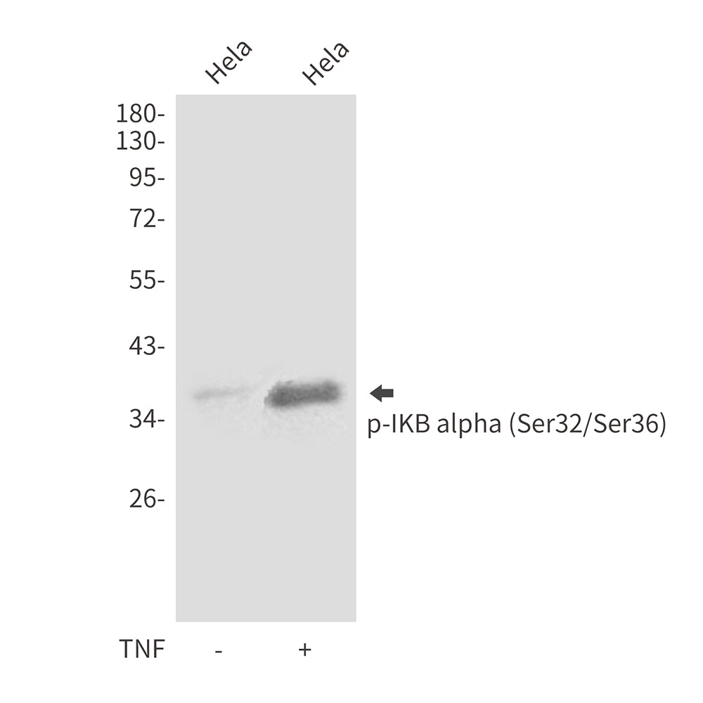 Anti-Phospho-IKB alpha (Ser32/Ser36) Rabbit Polyclonal Antibody