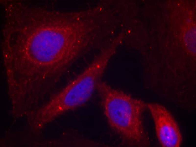 Anti-Phospho-PAK1 (Thr212) Rabbit Polyclonal Antibody
