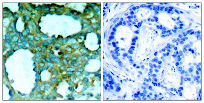Anti-Phospho-PAK1 (Thr212) Rabbit Polyclonal Antibody