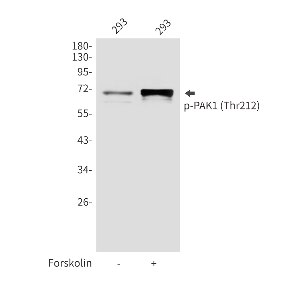 Anti-Phospho-PAK1 (Thr212) Rabbit Polyclonal Antibody