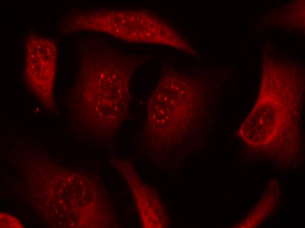 Anti-Phospho-FOXO3 (Ser253) Rabbit Polyclonal Antibody