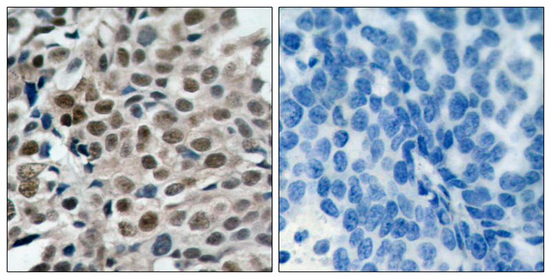 Anti-Phospho-FOXO3 (Ser253) Rabbit Polyclonal Antibody
