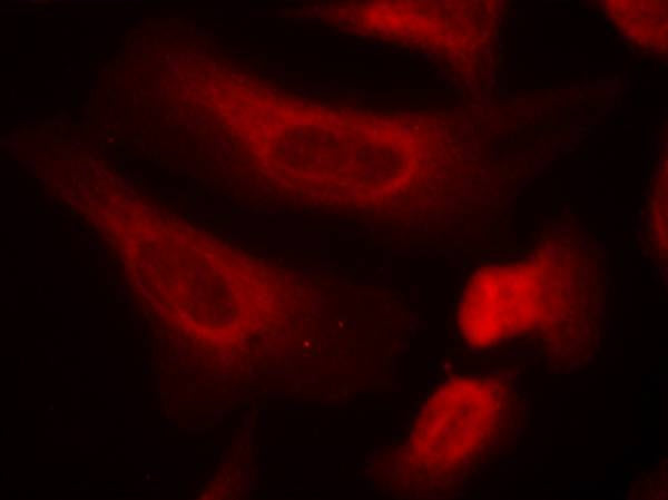 Anti-Phospho-STAT1 (Ser727) Rabbit Polyclonal Antibody