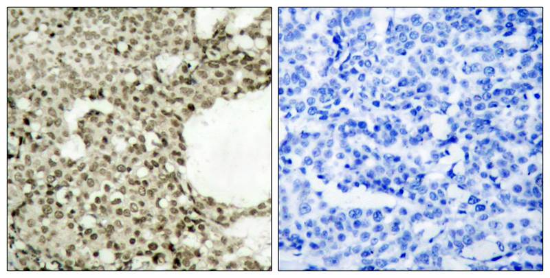 Anti-Phospho-STAT1 (Ser727) Rabbit Polyclonal Antibody