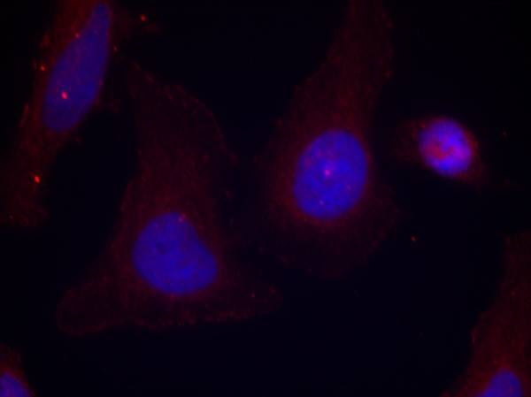 Anti-Phospho-PYK2 (Tyr402) Rabbit Polyclonal Antibody