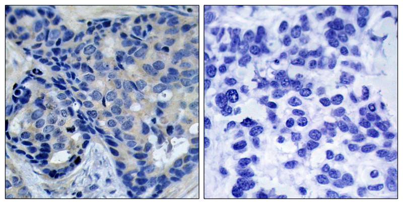 Anti-Phospho-PYK2 (Tyr402) Rabbit Polyclonal Antibody