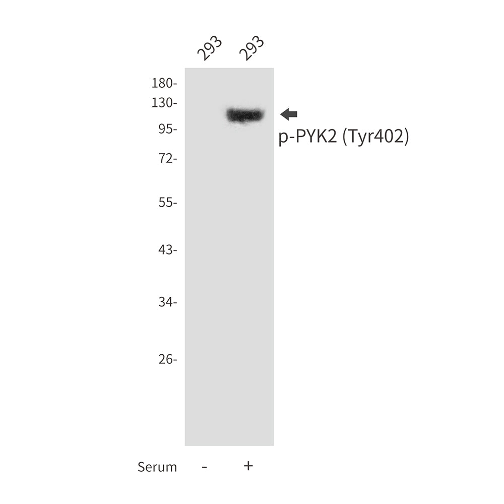Anti-Phospho-PYK2 (Tyr402) Rabbit Polyclonal Antibody